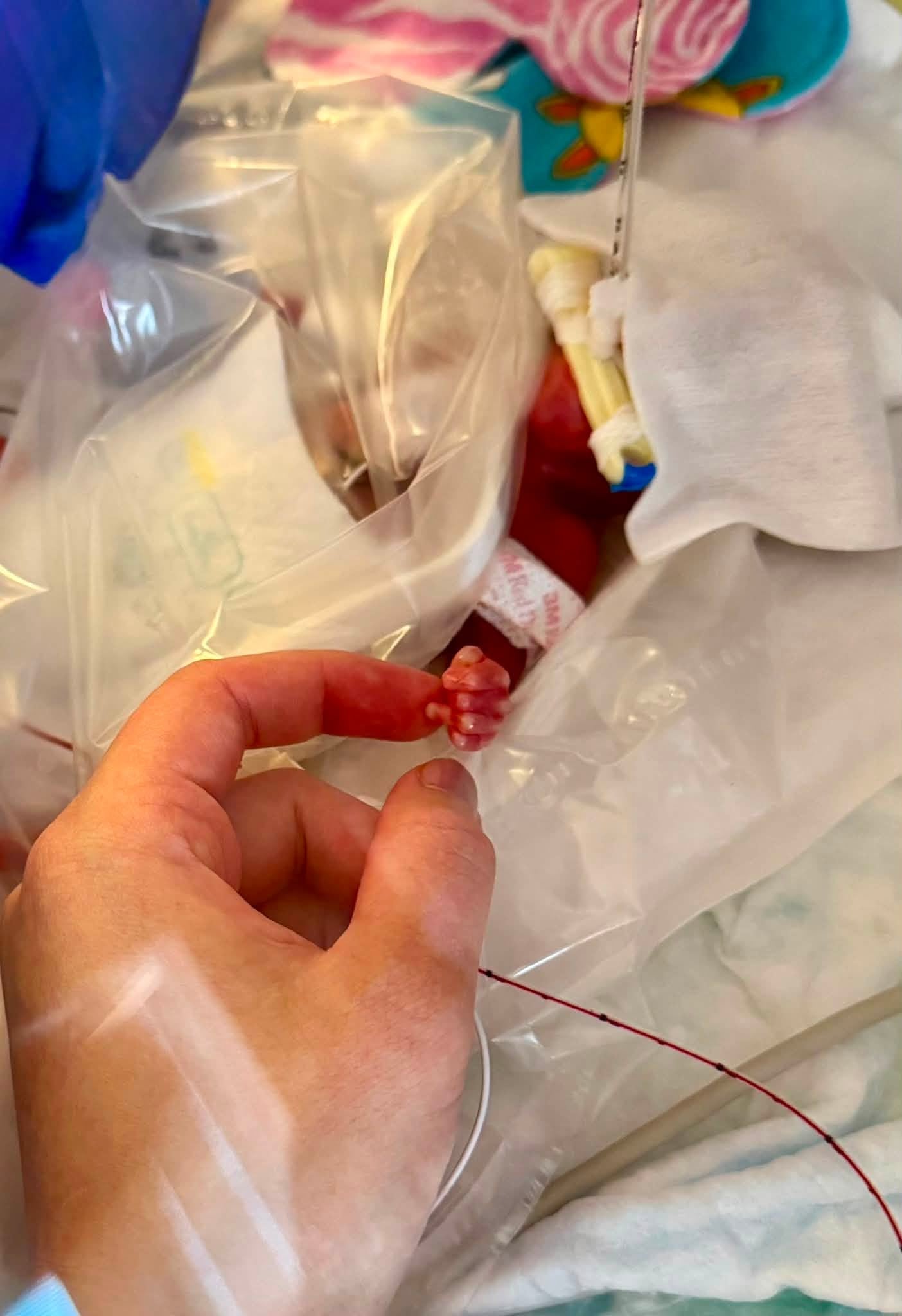 Wisconsin Baby Discharged After 375 Days in NICU, Reportedly Smallest Survivor