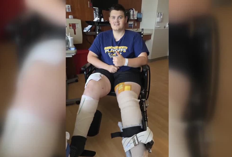 Mason Kramer, 18, fell and got his legs stuck in a silo unloader while working on his farm. He...