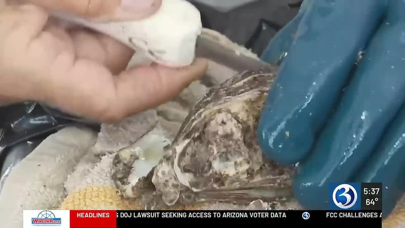 Flesh-eating bacteria case reported in Connecticut