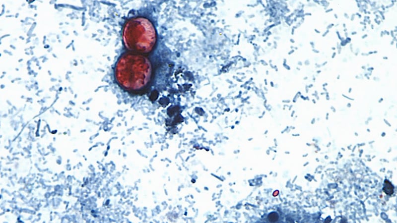 FILE - This undated photo taken through a microscope provided by the CDC shows Cyclospora...